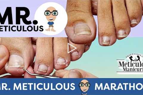 👣Pedicure Tutorial Impacted Toenails with ASMR👣 #MrMeticulousMarathon