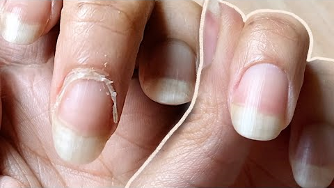 NAIL TRANSFORMATION / HOW I CUT CUTICLES AT HOME PERFECTLY  / Basic Tools ONLY