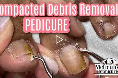 👣Deep Pedicure Cleaning and Compacted Debris Removal👣