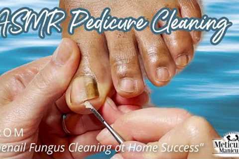 👣ASMR Pedicure Cleaning💆‍♀️Toenail Fungus Cleaning at Home Success👣