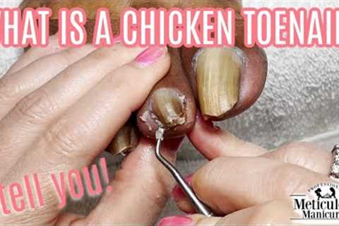 👣What is a Chicken Toe PEDICURE TUTORIAL👣