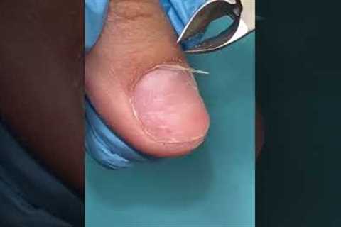 CUTTING CUTICLES 🤢😱💅🏼 (SO SATISFYING)