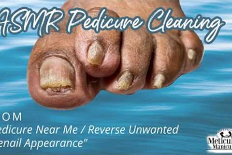 👣ASMR Pedicure Cleaning💆‍♀️Pedicure Near me & Reverse Unwanted Toenail Appearance..