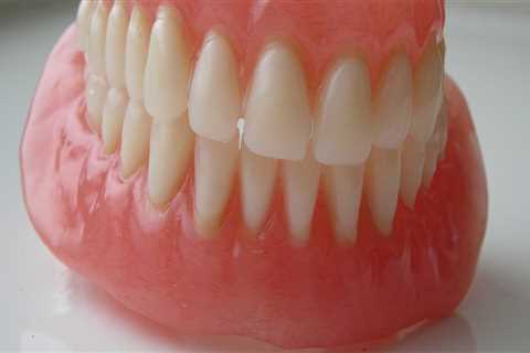 What Type of Dentures Are The Best