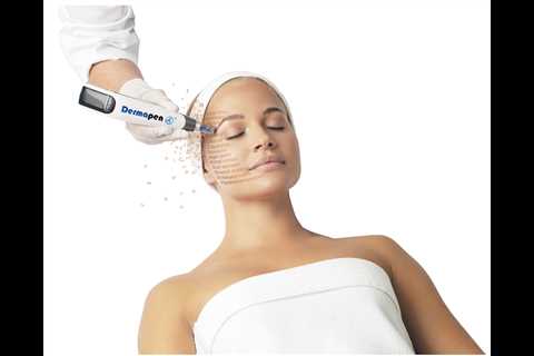 At-Home vs Professional Microneedling: Pros, Cons & Is It Worth The Risk?